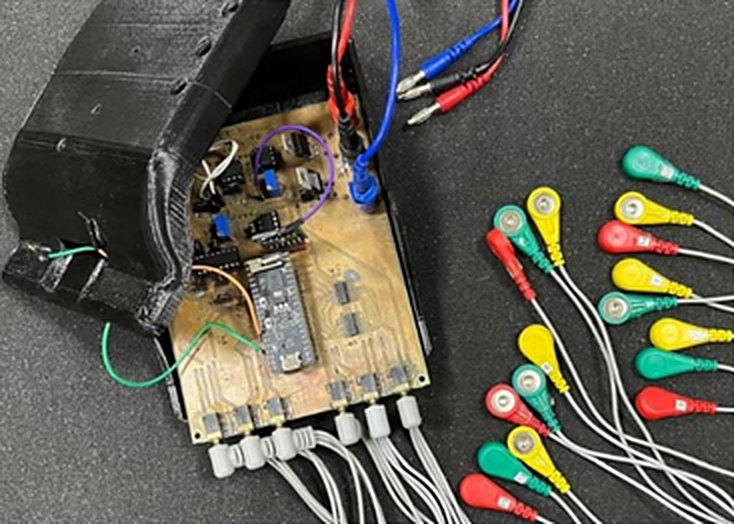 Prototipo de LIA: placa electrónica dentro de una carcasa negra, conectada a los cables de los electrodos.